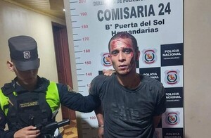 Muere joven quemado en brutal agresión en Hernandarias