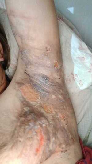 Popular / Suegra derramó agua hirviendo a su nuera