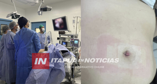 HOSPITAL GENERAL DE ITAPÚA REALIZA CIRUGÍAS SIN DEJAR HUELLAS EN PACIENTES