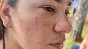 Abogada denuncia que mujeres insultaron a arquero con autismo en partido de Sub 13