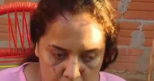 La Nación / Mujer denunció a su vecina por agredirla con un mazo