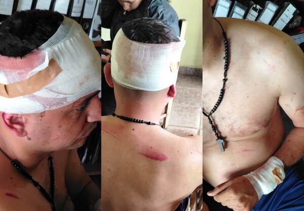 Guardia “despertó” a machetazos a su rival •