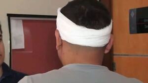 Hombre fue macheteado por la expareja de su novia