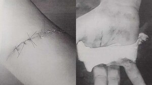 Machetearon a un tipo y les "castigaron" a ir a curso de autoayuda