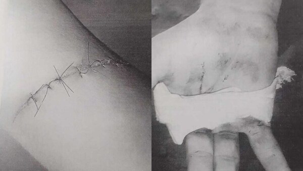 Machetearon a un tipo y les "castigaron" a ir a curso de autoayuda