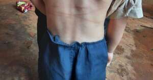 La Nación / Un papá habría pegado con varilla de plástico a su hijo de 3 años y está imputado