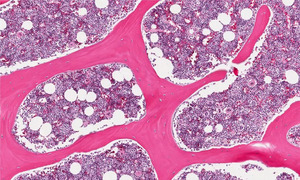 Científicos crean la primera médula ósea humana en laboratorio y abren una nueva era contra el cáncer - OviedoPress