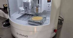 La Nación / San Ignacio, Misiones: realizan primera intervención de regeneración de piel con tecnología avanzada