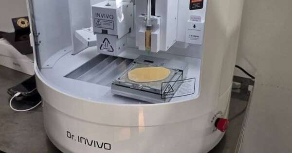 La Nación / San Ignacio, Misiones: realizan primera intervención de regeneración de piel con tecnología avanzada