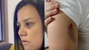 Dos mujeres se moquetearon en el baño de una disco por un amorkue