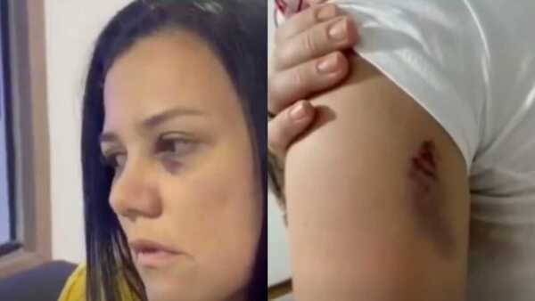 Dos mujeres se moquetearon en el baño de una disco por un amorkue