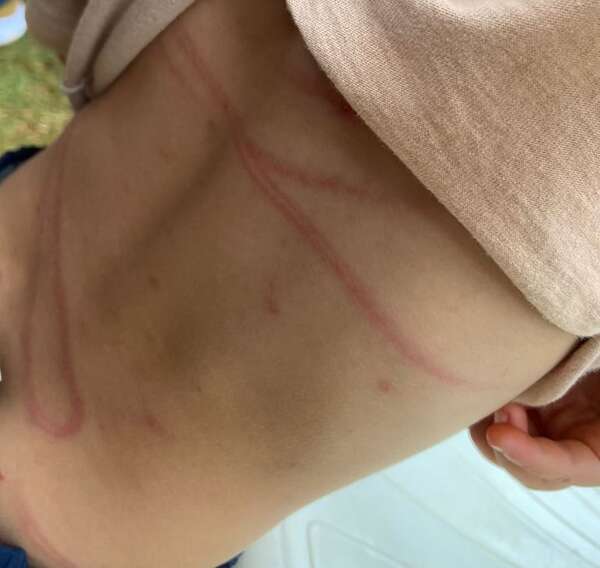 Imputan a joven de 18 años por brutal castigo a su hijo de 2 años - ABC en el Este - ABC Color