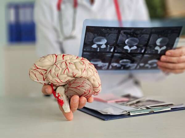 Los astrocitos pueden eliminar las placas del alzhéimer y preservar la función cognitiva - Ciencia - ABC Color