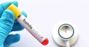 La Nación / Alertan sobre aumento de casos de sífilis en Asunción y zonas fronterizas