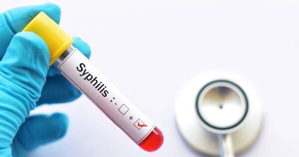 La Nación / Alertan sobre aumento de casos de sífilis en Asunción y zonas fronterizas