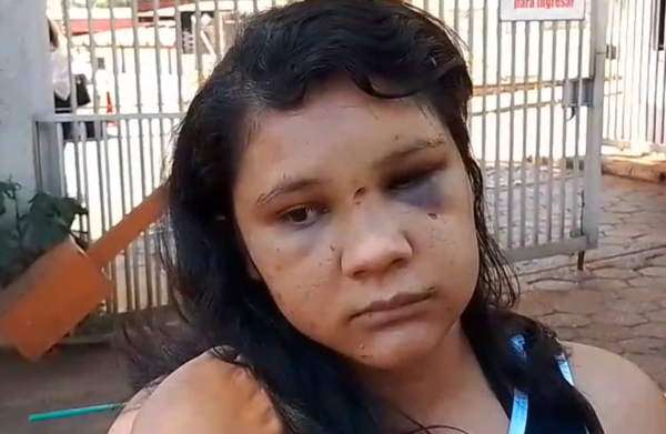 Mujer denuncia a su expareja: “Dijo que mi cuerpo van a recoger en una bolsa negra” | Unicanal