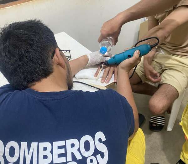 ¡Se le trancó el anillo en el dedo! Así lo auxiliaron los bomberos - Nacionales - ABC Color