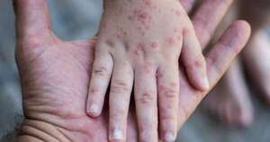 La Nación / Alto Paraná: preocupa baja vacunación contra el sarampión a poco de terminar el año