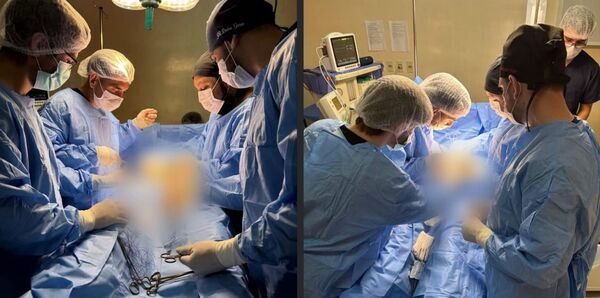 Cirugías itinerantes en Tomás Romero Pereira reducen la lista de espera y alcanzan a pacientes de zonas rurales