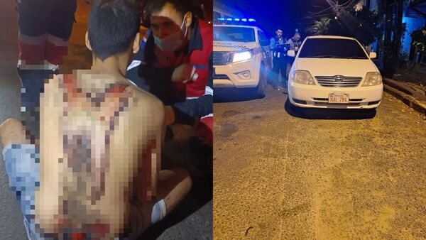 Conductor ebrio arrolló y arrastró  a joven con discapacidad en Encarnación