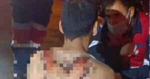 La Nación / Encarnación: conductor ebrio arrolló a un hombre con discapacidad