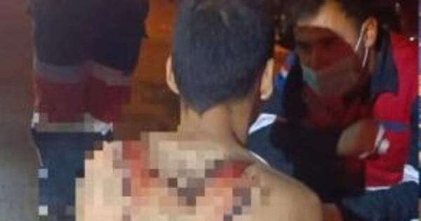 La Nación / Encarnación: conductor ebrio arrolló a un hombre con discapacidad