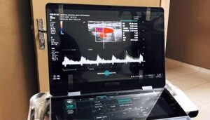 Fortalecen atención cardiológica en el Chaco con nuevo equipo de ecocardiografía