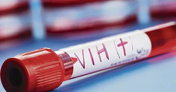 La Nación / Diagnosticaron 1.350 nuevos casos de VIH/Sida este año