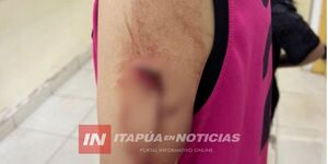 ATAQUE A PUÑALADAS DE QUINCEAÑERA HABRÍA SIDO MOTIVADO POR CELOS