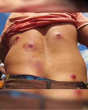 Represión policial en Santa Rosa: denuncian hay niños heridos - Portal Digital Cáritas Universidad Católica