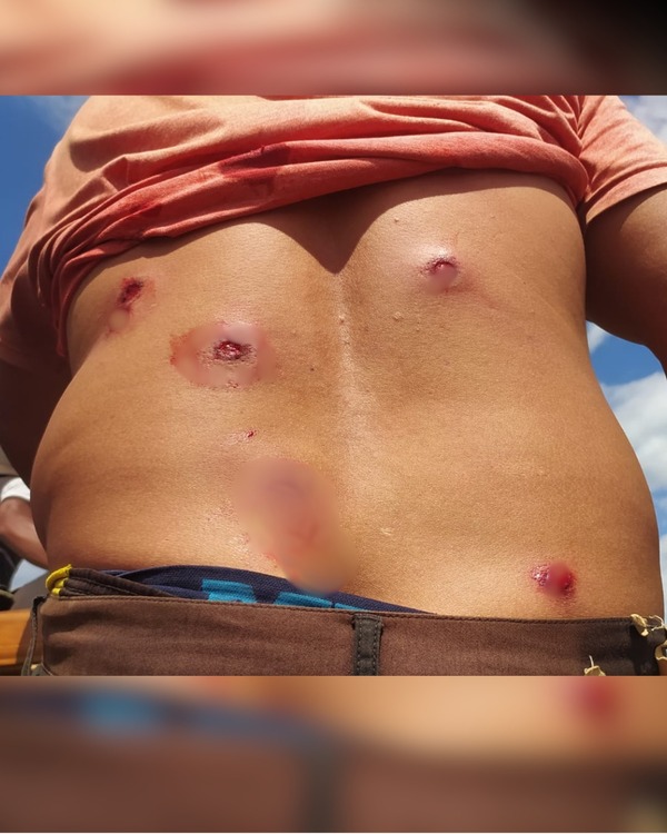 Represión policial en Santa Rosa: denuncian hay niños heridos - Portal Digital Cáritas Universidad Católica