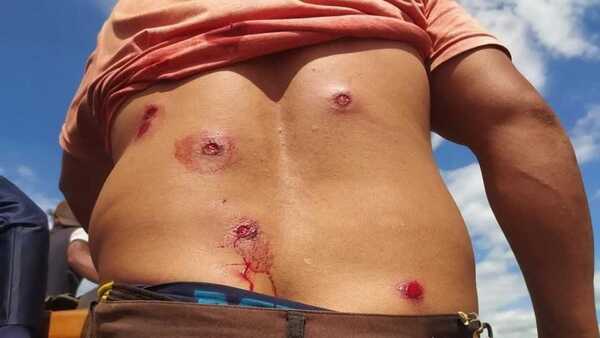 Codehupy expresa preocupación por violencia, criminalización y falta de dialogo con campesinos en San Pedro