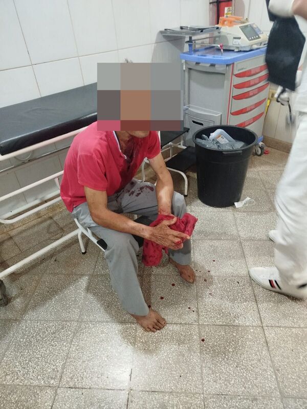 Violenta agresión deja herido grave a un hombre en Yby Yaú - Concepción al Día