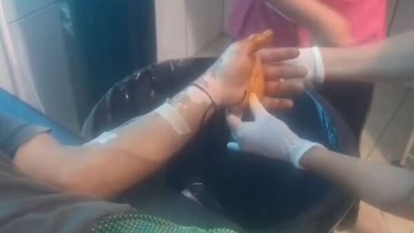 Trabajador fue atacado por una víbora venenosa