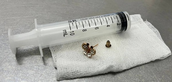 Popular / ¡Bebé de 10 meses omokõ un arito y la salvaron!