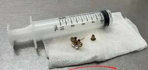 Bebé tragó un “arito”: instan a tener cuidado con objetos pequeños  - Nacionales - ABC Color