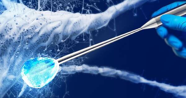 Diario HOY | Crioanalgesia contra el dolor crónico: “El alivio es real”