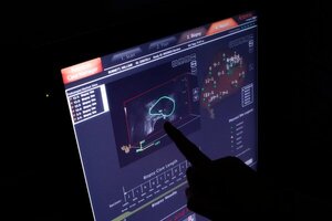 Ahora hay más diagnósticos de cáncer. Es posible que no se necesiten más tratamientos