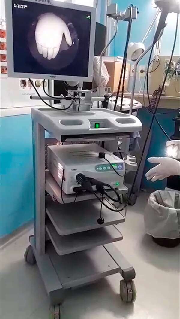 Escándalo en el Incan: detectan segundo equipo médico “carneado”  - Nacionales - ABC Color