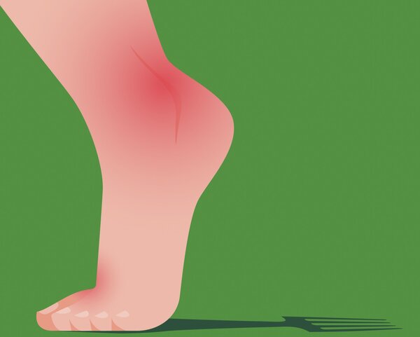 ¿Qué es la gota y por qué va en aumento?