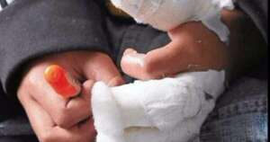 La Nación / Ministerio de Salud lanzó campaña de prevención de quemaduras por pirotecnia