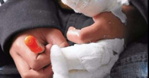 La Nación / Ministerio de Salud lanzó campaña de prevención de quemaduras por pirotecnia