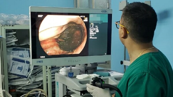 El Incan prestó un endoscopio al Hospital de Barrio Obrero hace un año y aún no lo devuelven