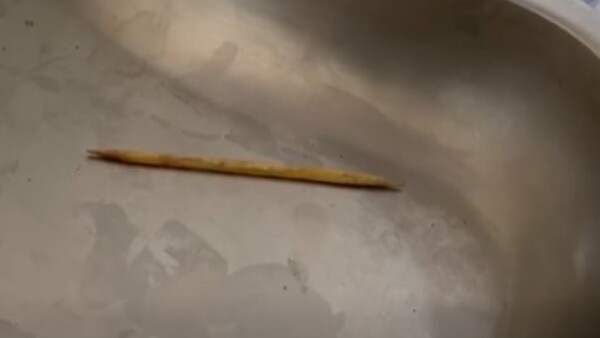 Comía lomito, pero sin querer se tragó el palito