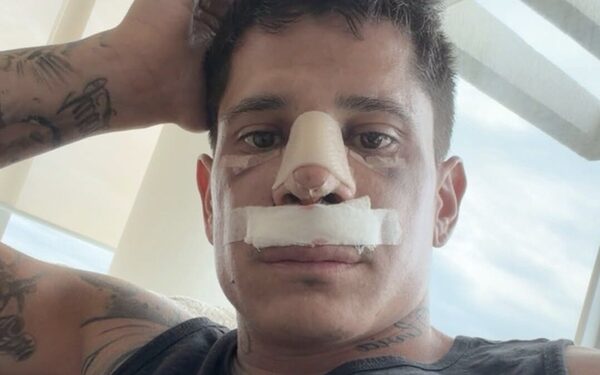 Popular / ¿Qué la pasó a Iturbe?