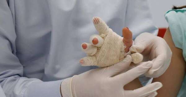 Diario HOY | Cuatro casos por quemaduras con petardos ya fueron atendidos antes de la Navidad