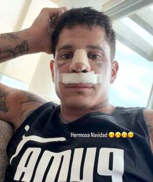 Cerro Porteño: Iturbe es el cuarto campeón operado - Cerro Porteño - ABC Color