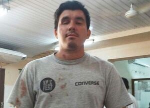 31M: PERDIÓ UN OJO EN LAS MANIFESTACIONES Y DEMANDA AL ESTADO POR 2.500 MILLONES