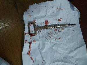 UN MUERTO Y CUATRO DETENIDOS EN ARROYO PORÃ