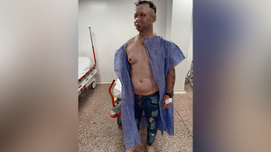 Hieren con arma blanca a un hombre en el barrio Nueva Esperanza de Encarnación